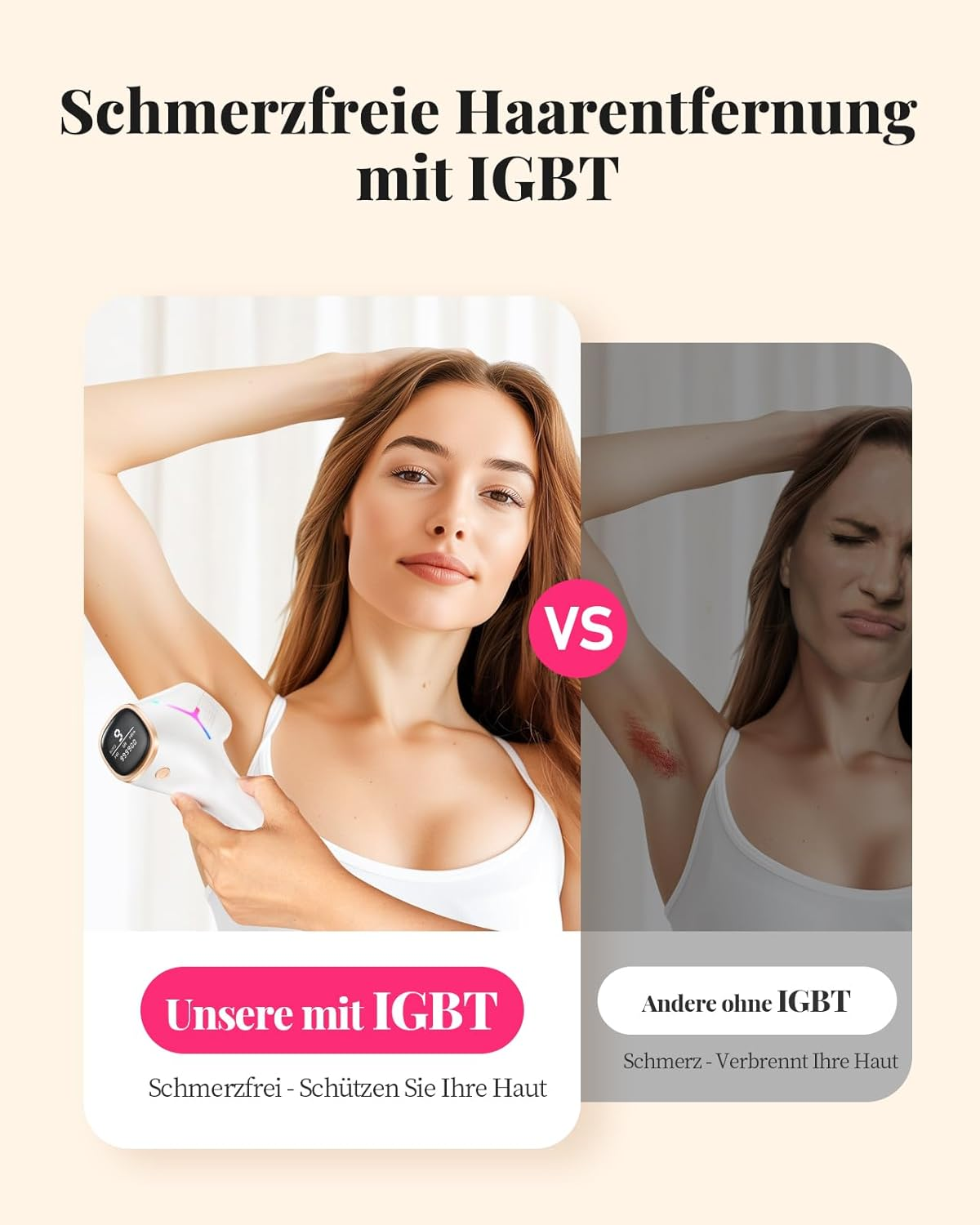 Vergleich zweier Methoden der Haarentfernung: eine schmerzfreie mit IGBT, eine schmerzhafte ohne IGBT.