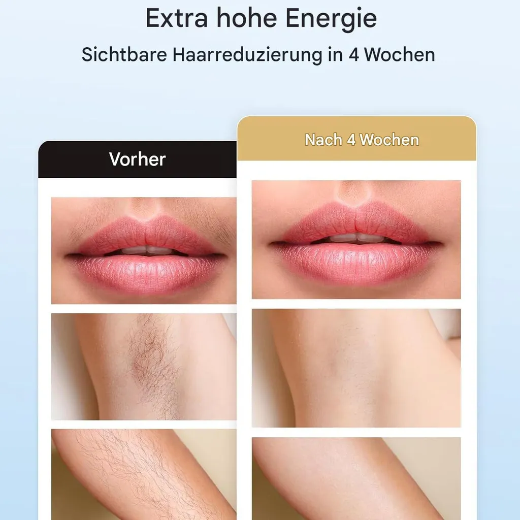 Vorher/Nachher-Vergleich von Haarentfernung an Oberlippe, Achseln und Arm.