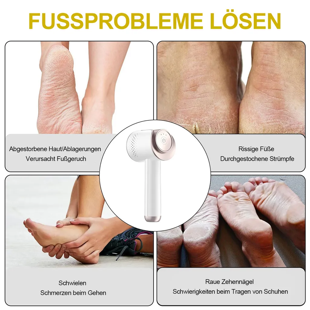 Ein Bild zeigt Fußprobleme: trockene Haut, rissige Füße, Schwielen und raue Zehennägel.