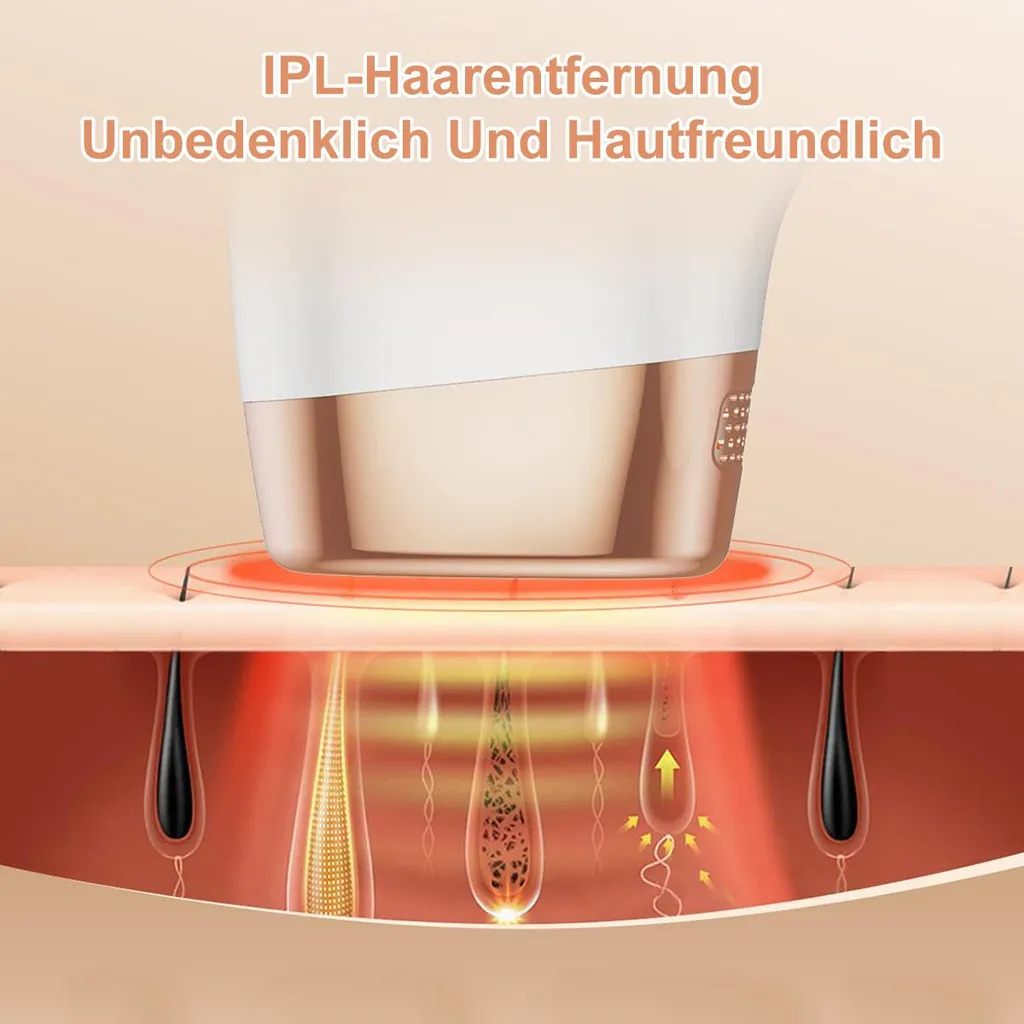 IPL-Haarentfernungsgerät über Hautschichten mit Haarfollikeln, die behandelt werden.