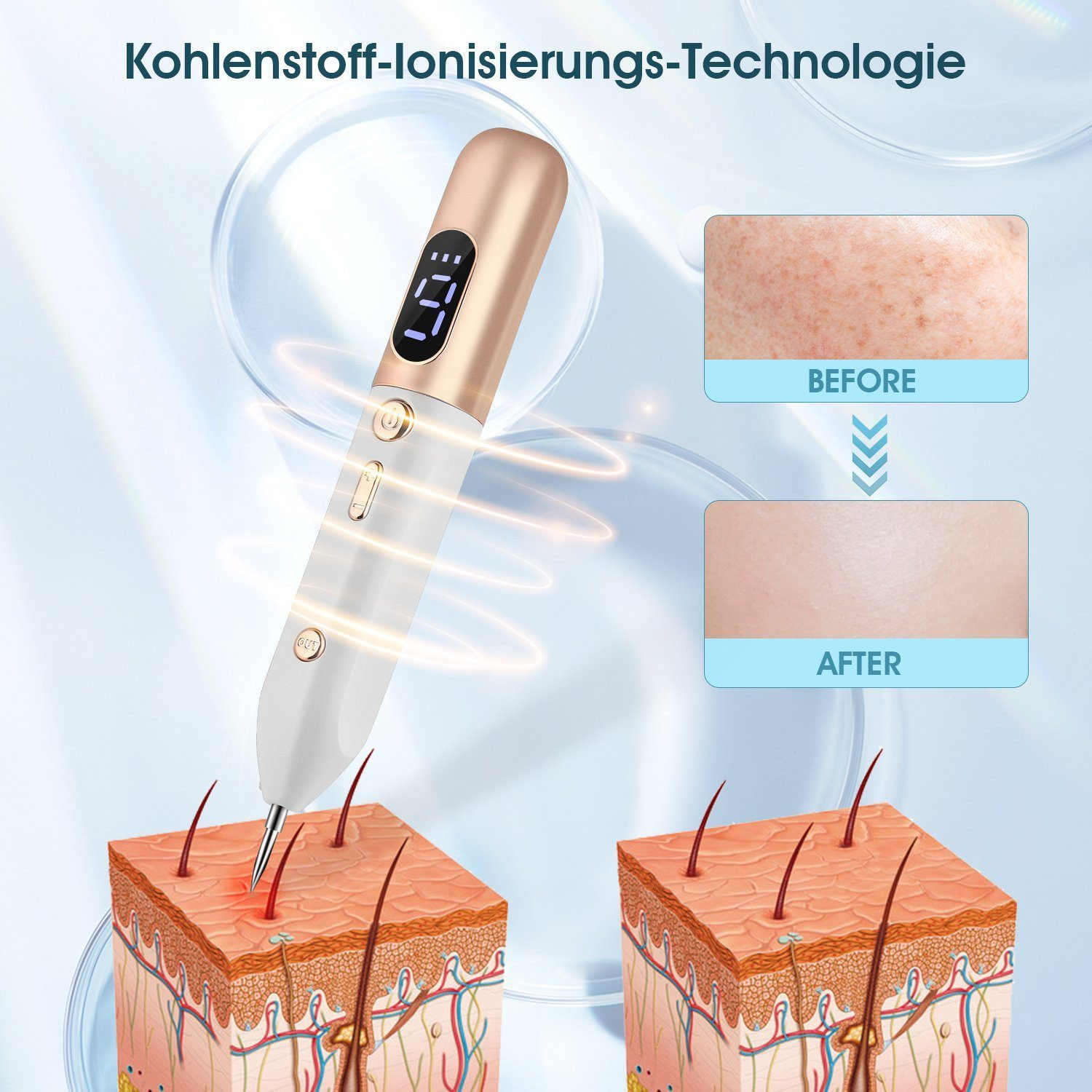Ein Hautbehandlungsstift zeigt Haut vor und nach der Behandlung, mit Hautschichten.