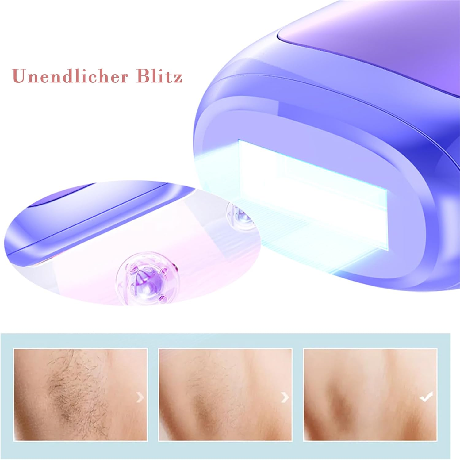 Ein violetter Epilierer mit Lichtblitz und Vorher-Nachher-Bildern von Haarentfernung.