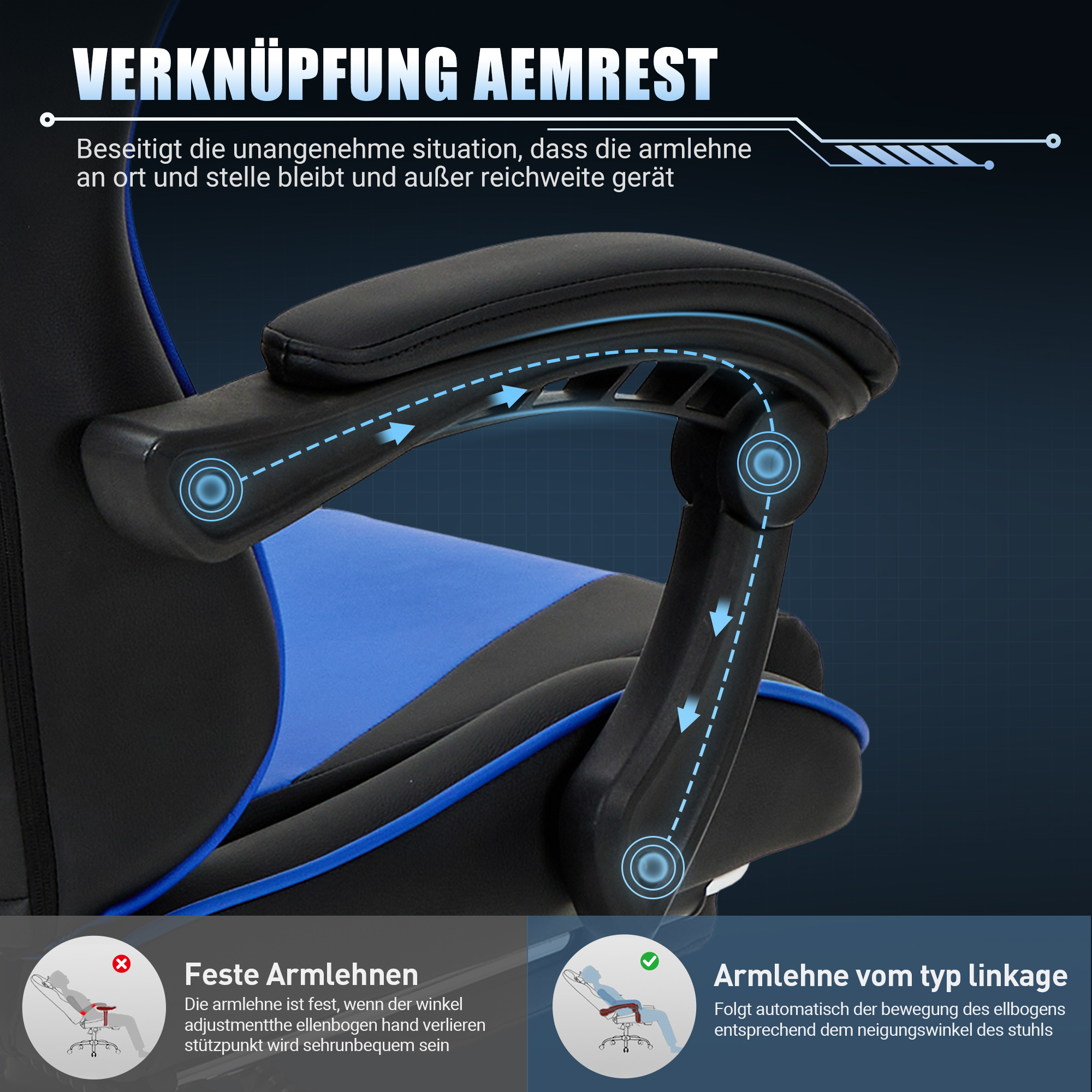 Reposabrazos de silla gamer con mecanismo de varillaje, mostrando opciones fijas vs. ajustables.