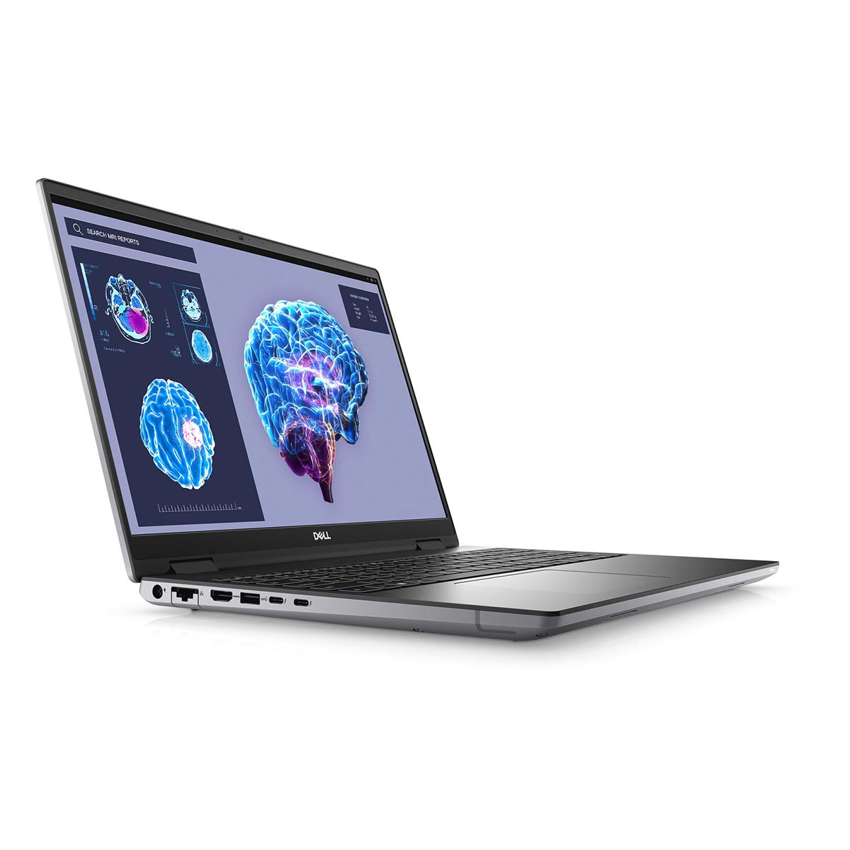 Ein offener Dell Laptop zeigt ein Gehirnbild auf dem Bildschirm.