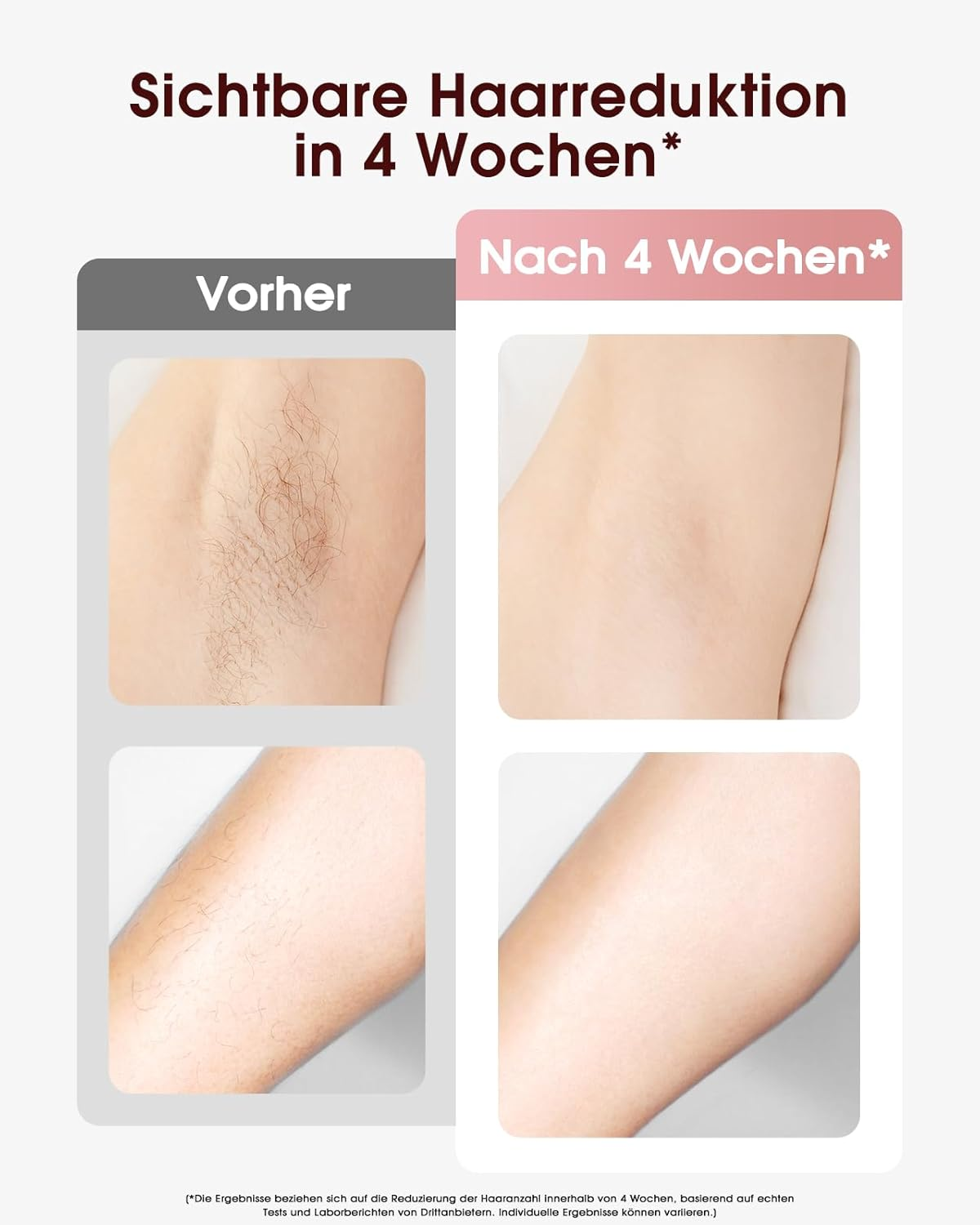 Vorher-Nachher-Bilder zeigen Haarreduktion am Arm und unter den Achseln.