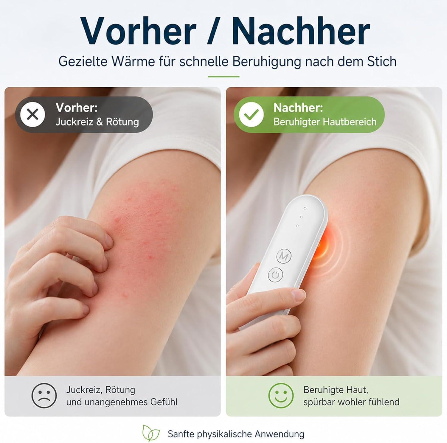 Vorher: juckende, rote Haut. Nachher: beruhigte Haut durch Wärmebehandlung.