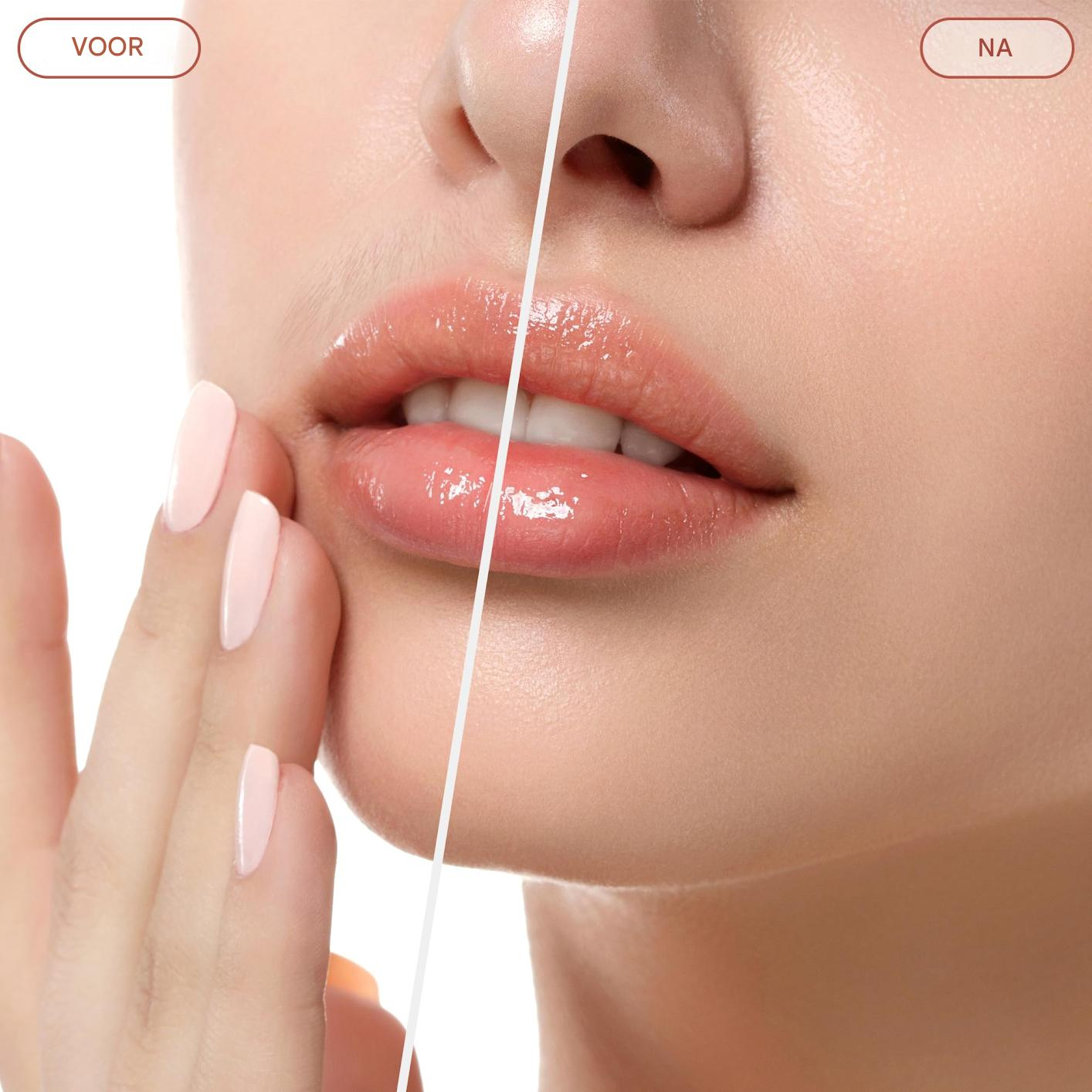 Vorher/Nachher-Vergleich: Lippen und Kinnpartie einer Frau mit glänzendem Lippenstift.