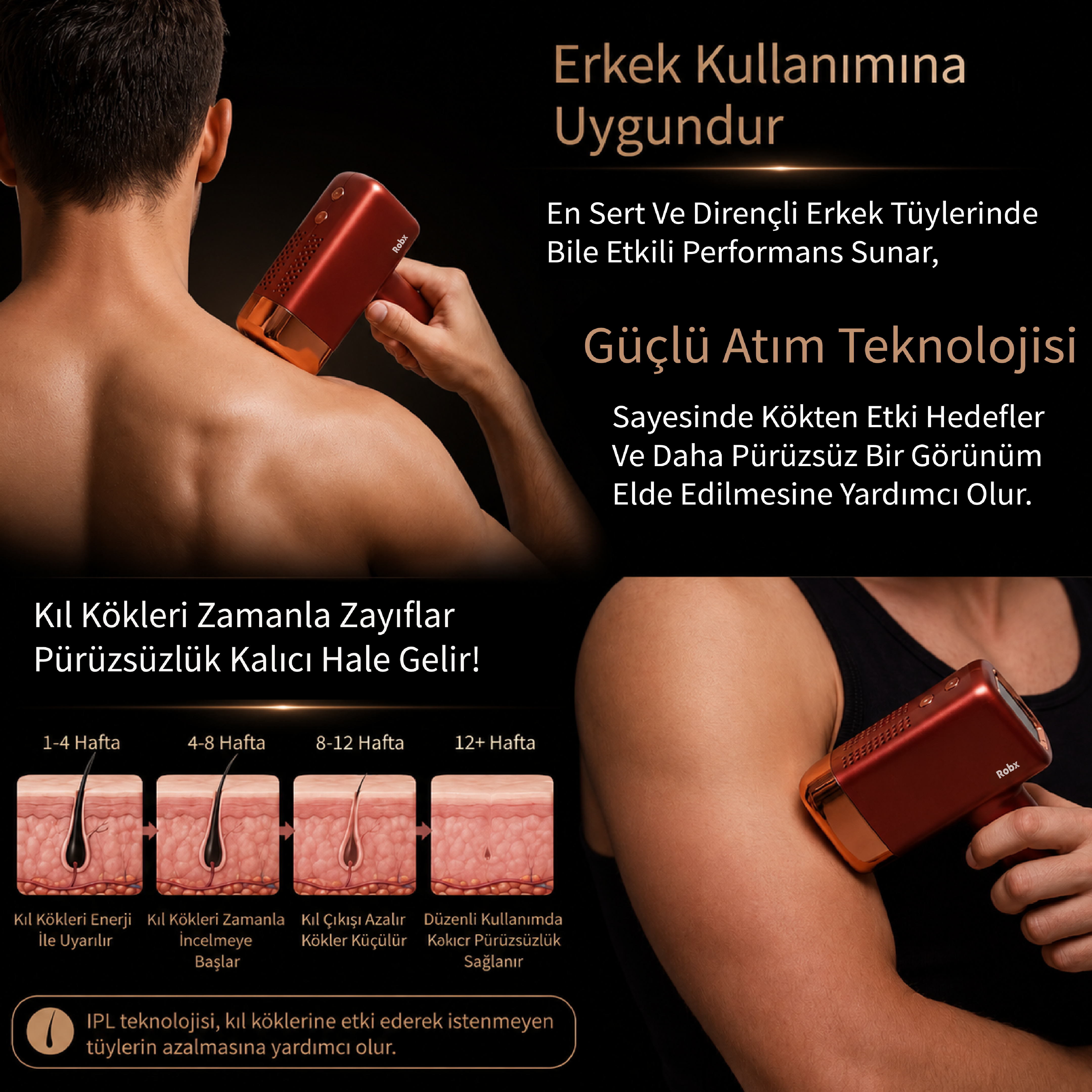 Erkek, sırtta IPL tüy dökücü kullanıyor. Cilt katmanları zamanla tüy büyümesini gösterir.