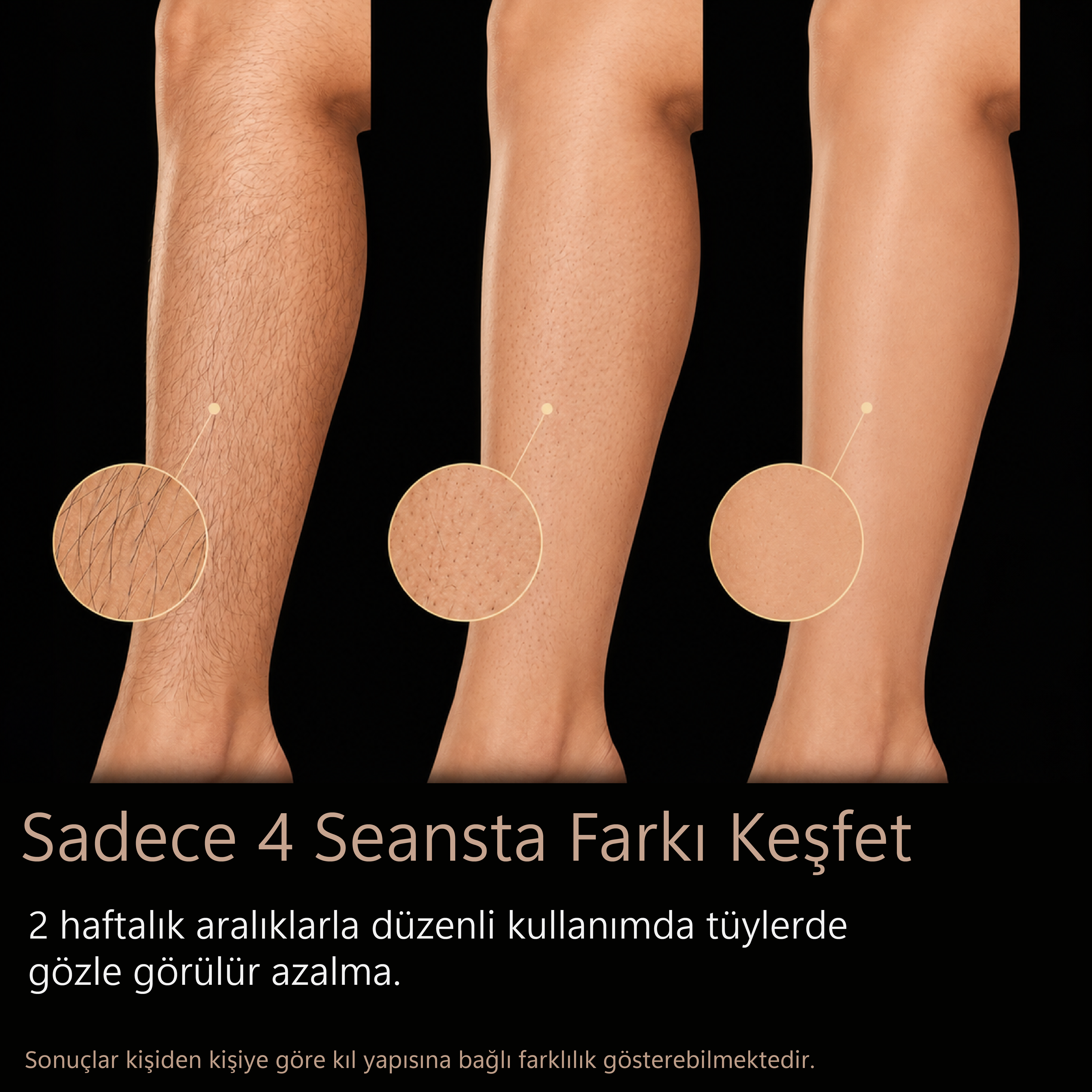 Tüylü, tüyleri azalmış ve pürüzsüz ciltli bacaklar yan yana gösteriliyor.