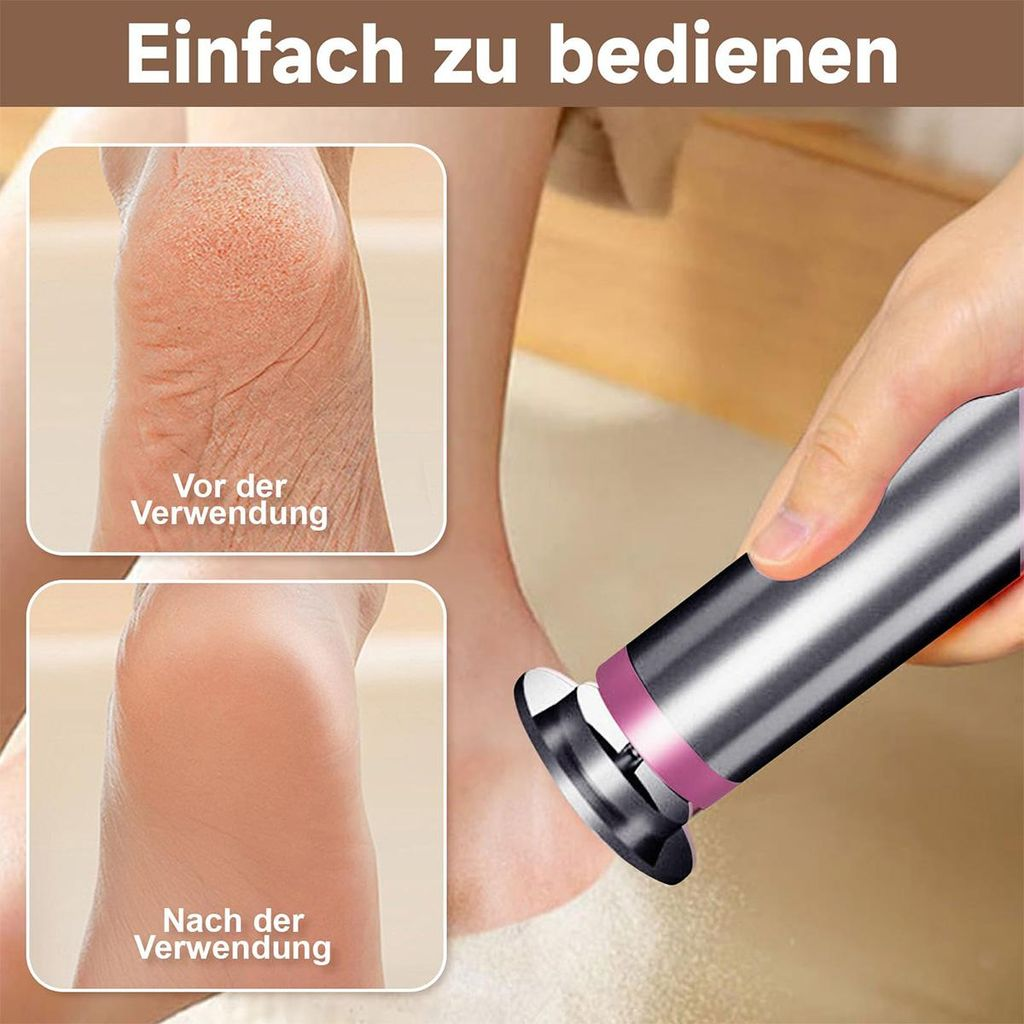 Vorher-Nachher-Vergleich einer Fußbehandlung mit elektrischem Hornhautentferner.