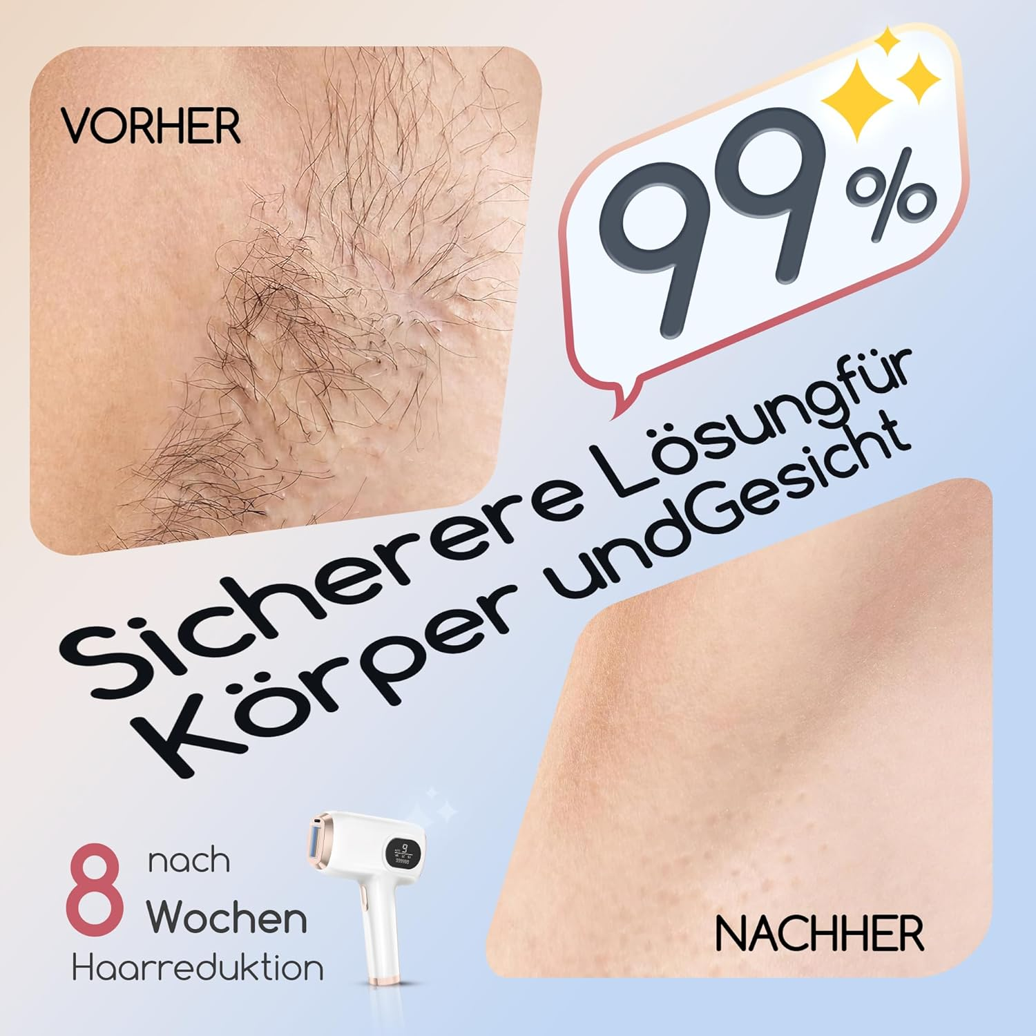 Vorher/Nachher-Vergleich von Haarentfernung mit 99% Lösung für Körper und Gesicht.