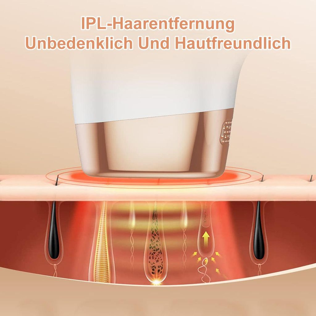 IPL-Haarentfernung: Das Gerät zeigt Haarfollikel unter der Haut und wie es Haare entfernt.