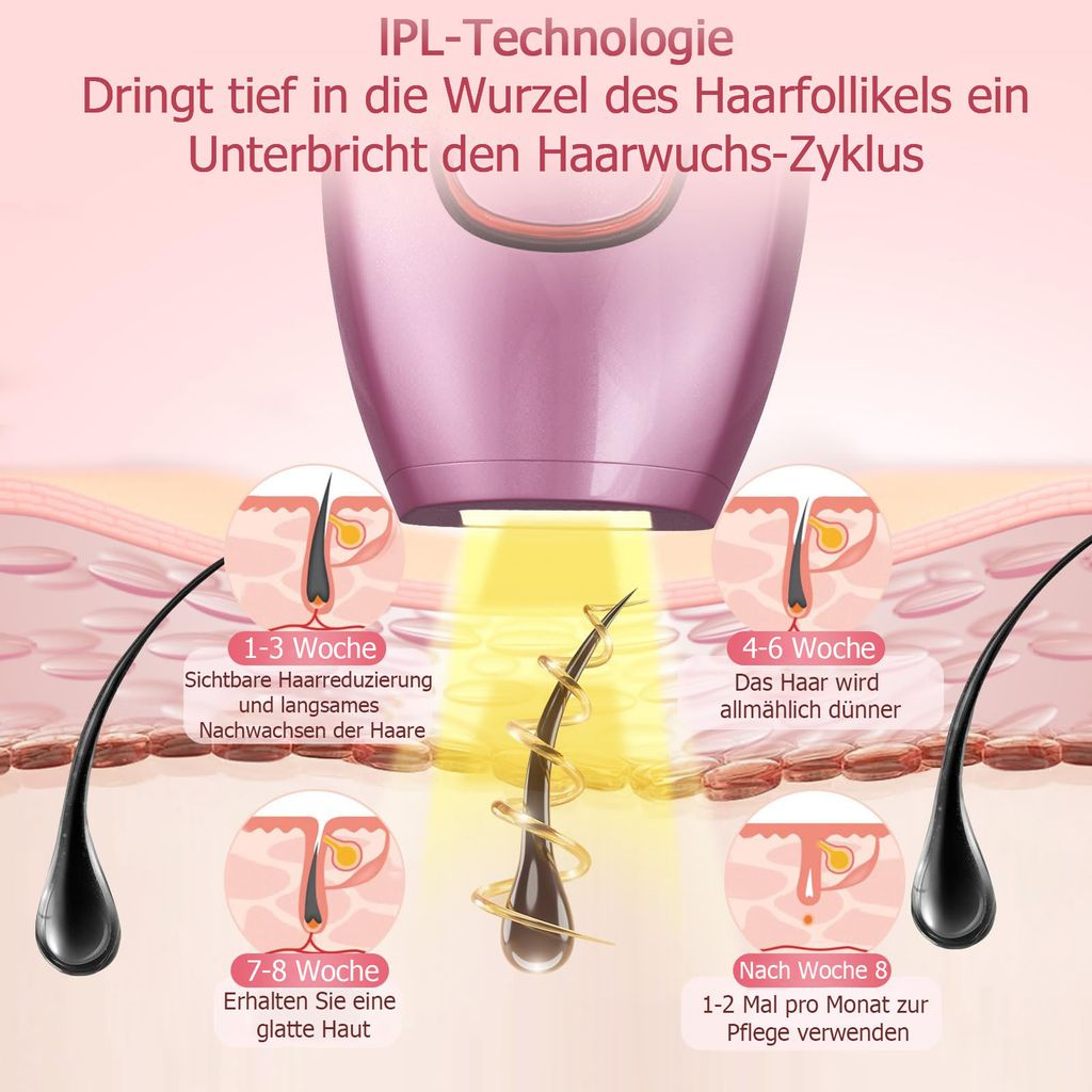 IPL-Gerät behandelt Haarfollikel, zeigt Haarreduktion über 8 Wochen.