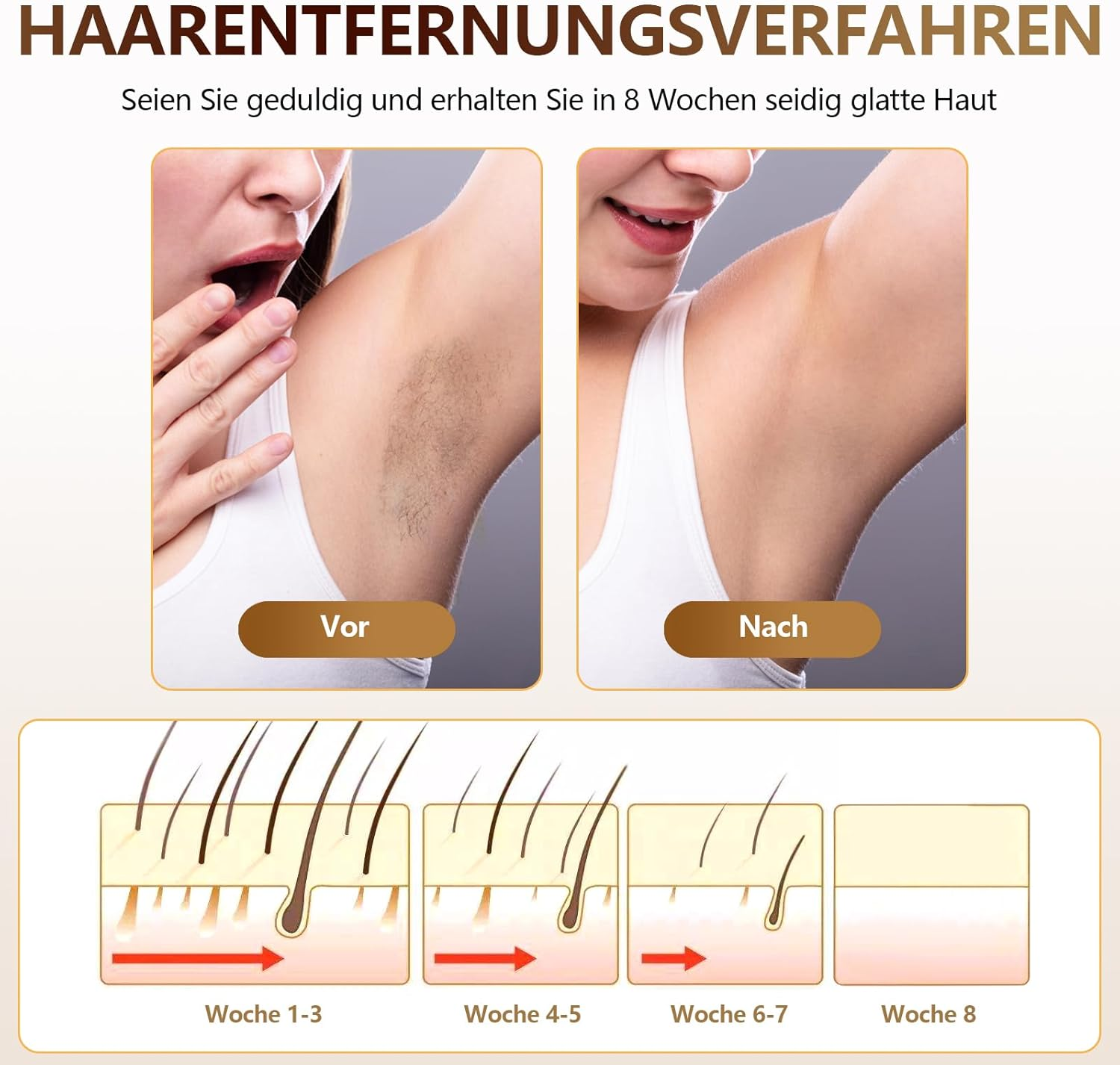 Vergleichsbilder vor und nach der Haarentfernung an der Achsel über 8 Wochen.