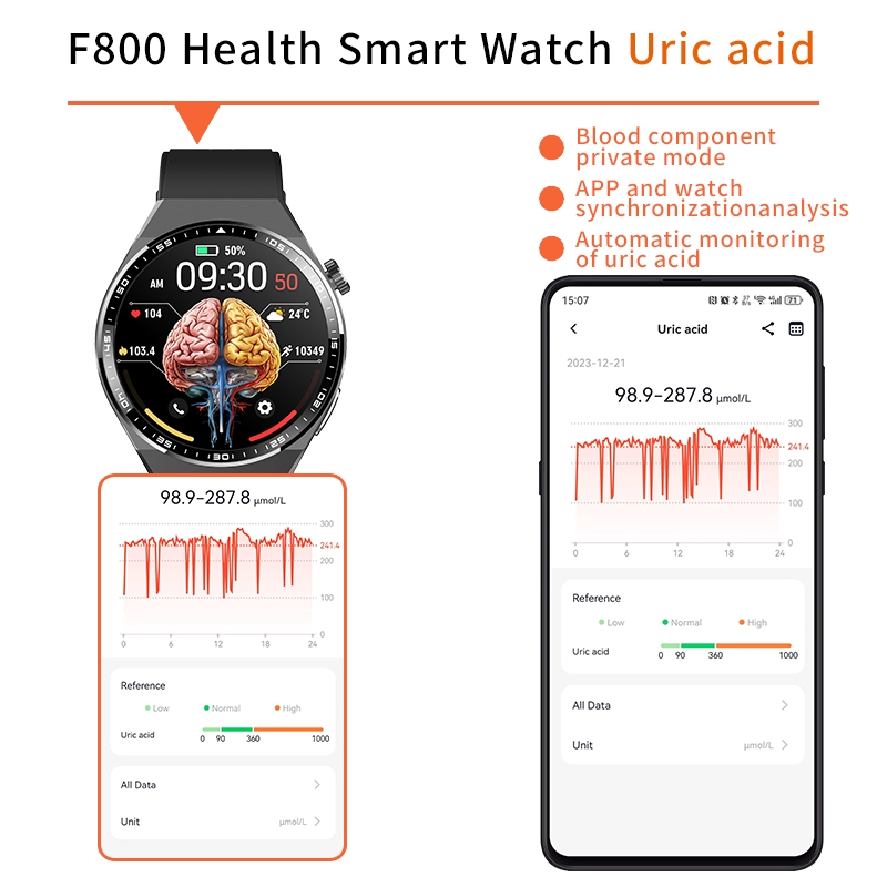 F800 Gesundheitssmartwatch und Smartphone zur Überwachung von Harnstoffsäure mit Gehirngrafik auf dem Zifferblatt.