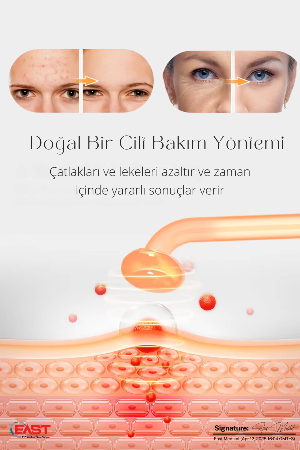 Önce ve sonrasında cilt değişimini ve hücresel tedaviyi gösteren infografik.