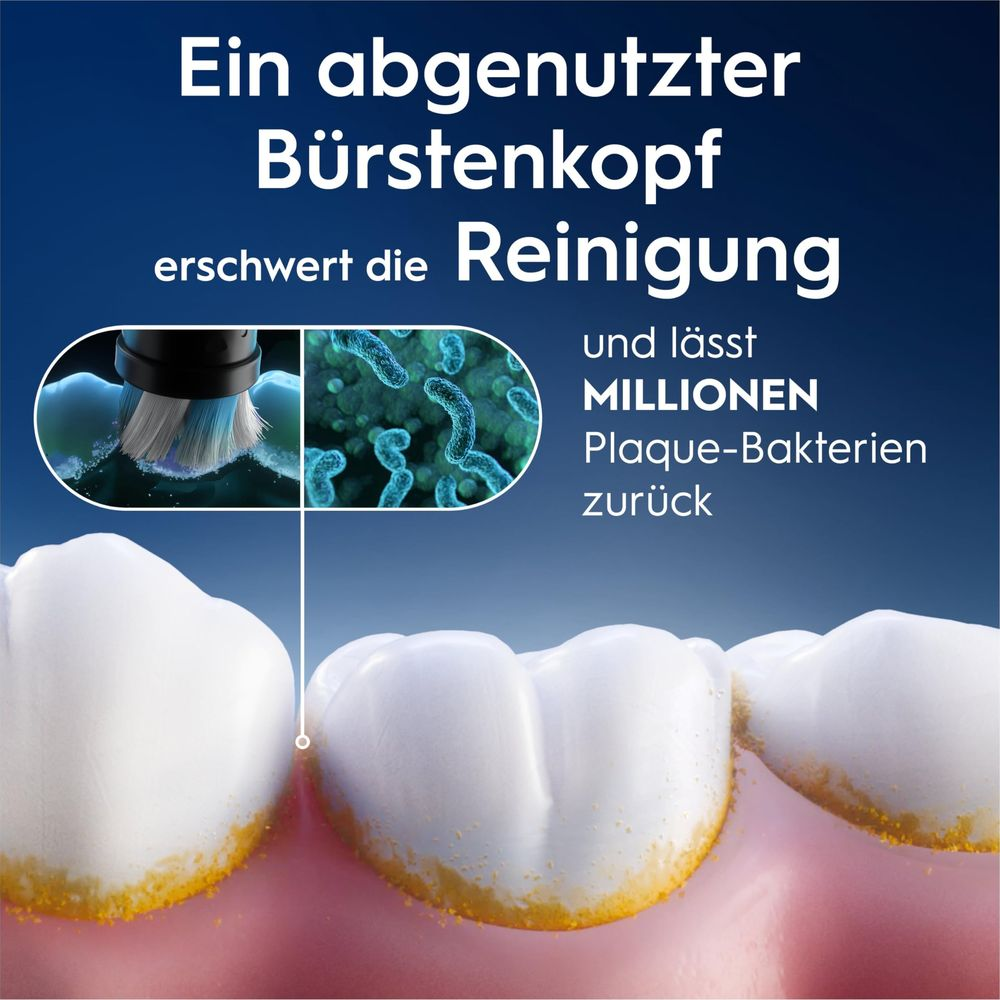 Une brosse usée nuit au nettoyage, laissant des millions de bactéries de plaque sur les dents.