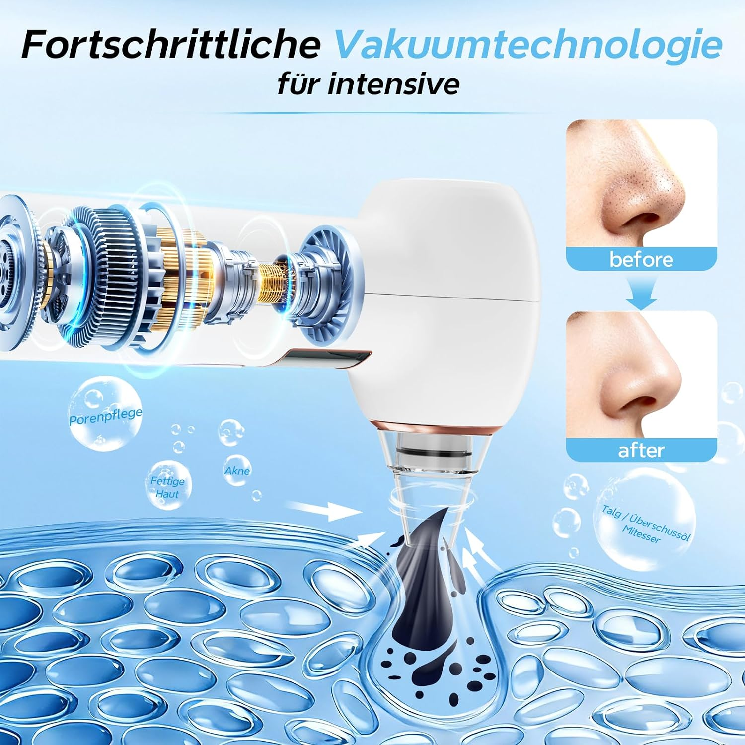 Diagramm zeigt Vakuum-Mitesserentferner mit Motorinneren und Vorher-Nachher-Nasenbildern.