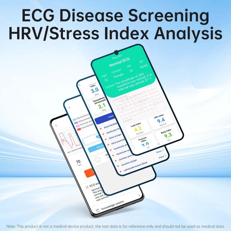 Smartphones display ECG disease screening and HRV stress index analysis.
