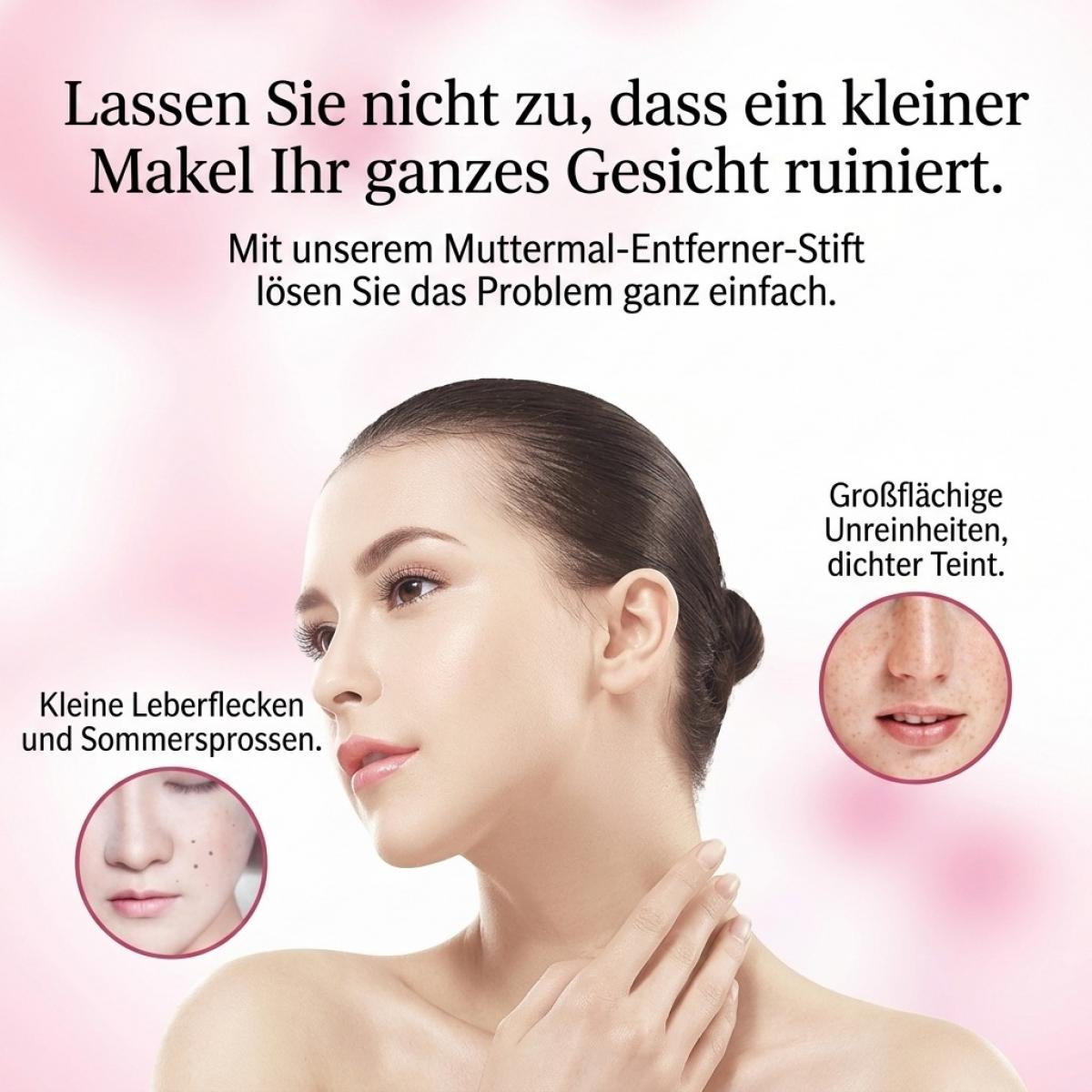 Werbebild für einen Muttermal-Entferner mit Frau und Zoom-In-Ansichten von Hautunreinheiten.