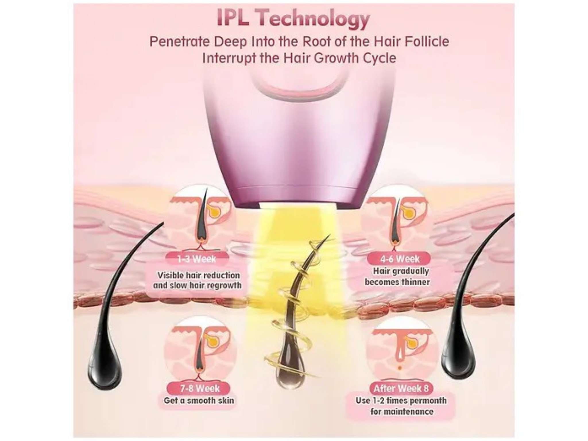 Diagramm zeigt IPL-Haarentfernungstechnologie mit Wirkung auf Haarfolikel im Zeitverlauf.