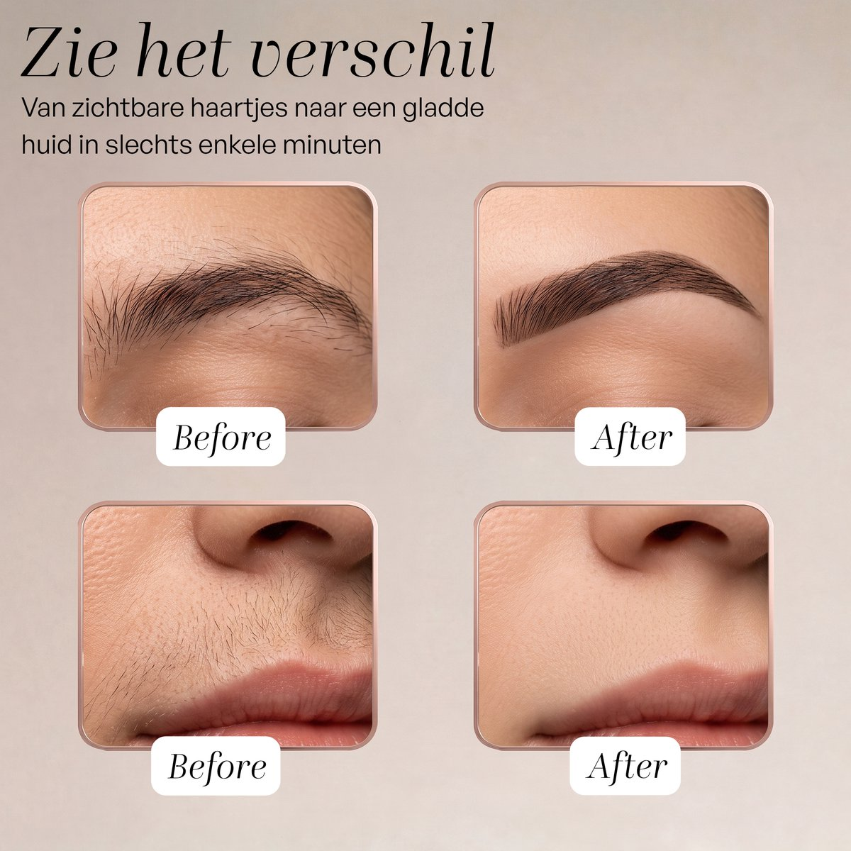 Voor-en-na vergelijking toont een gladdere huid na haarverwijdering bij wenkbrauw en lip.