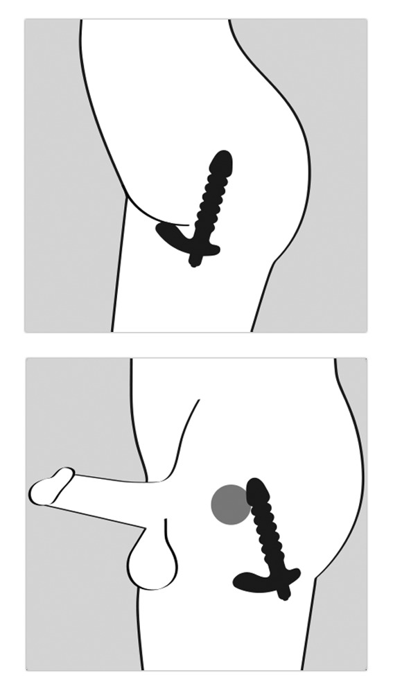 Diagramme zur Illustration der Platzierung eines Analtoys am menschlichen Körper.