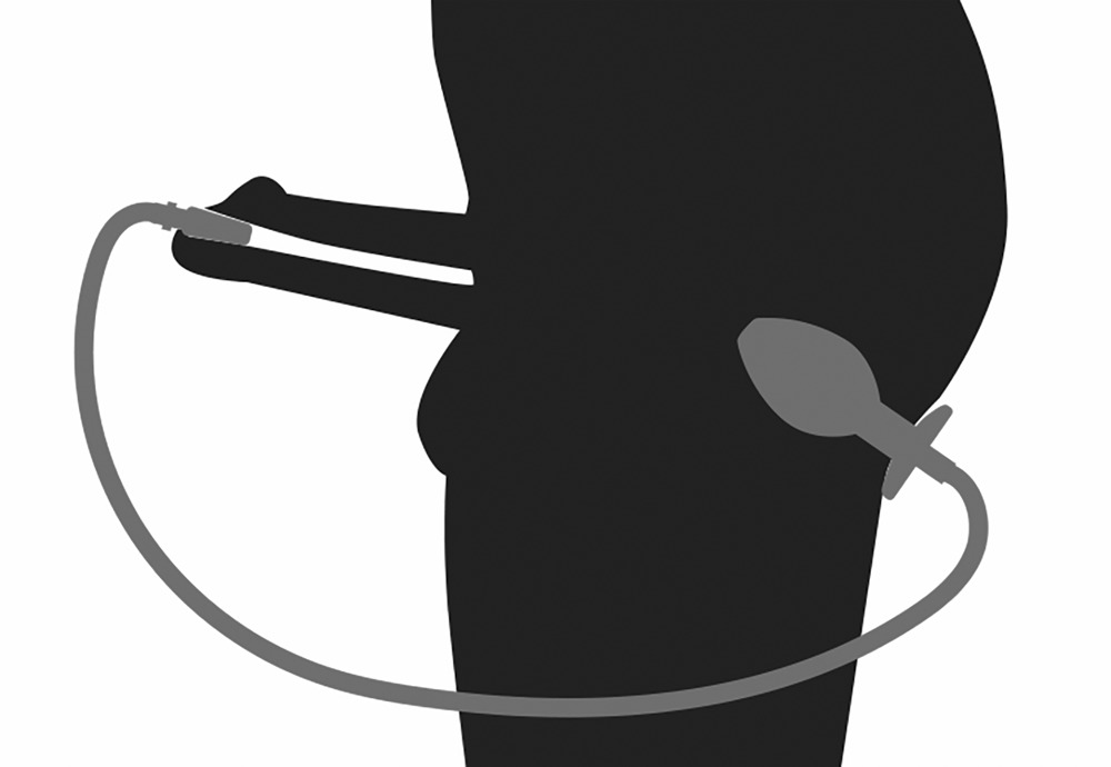Eine Schwarz-Weiß-Silhouette zeigt eine Person, die ein Pumpgerät hält, das mit einem analen Plug verbunden ist.