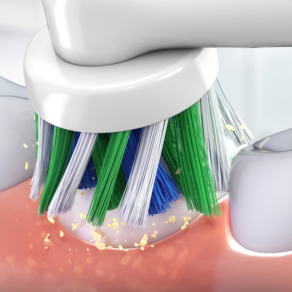 Eine elektrische Zahnbürste reinigt Zähne und entfernt gelbe Rückstände am Zahnfleisch.