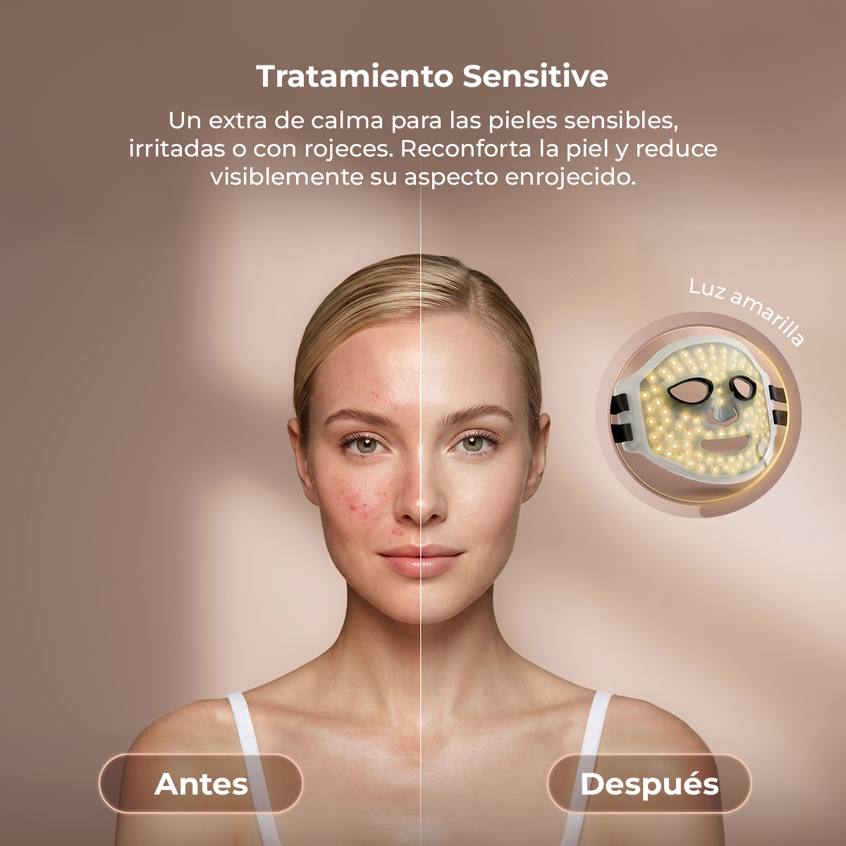 Confronto della pelle prima e dopo la terapia con luce LED gialla.