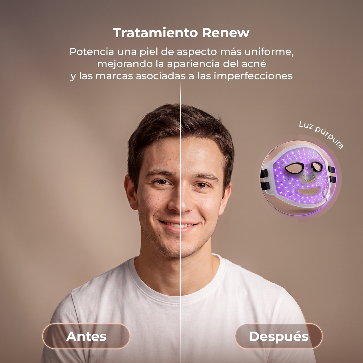 Un confronto prima e dopo di un uomo che mostra un trattamento viso con maschera LED viola.