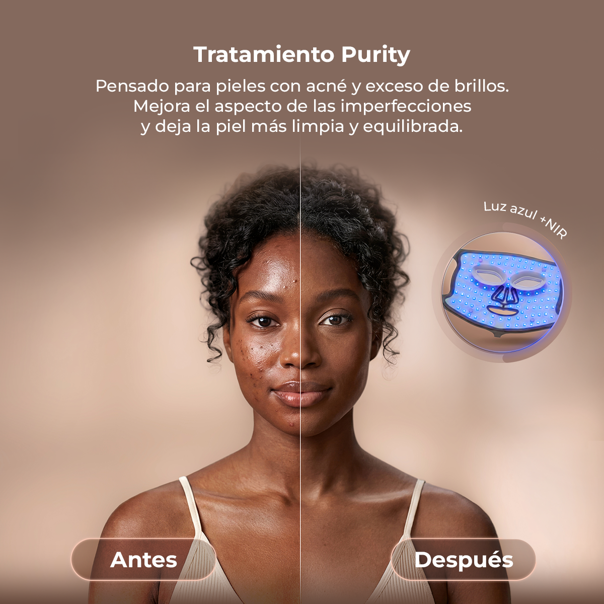 Confronto prima e dopo di un viso che mostra il miglioramento della pelle dopo il trattamento Purity.