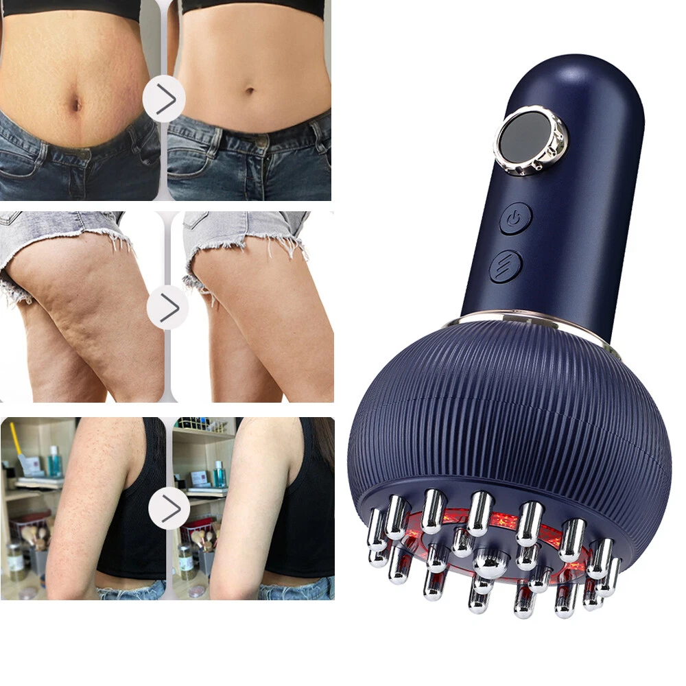 Ein blaues Körpermassagegerät mit Metallzinken und rotem Licht sowie Vorher-Nachher-Fotos der Haut.