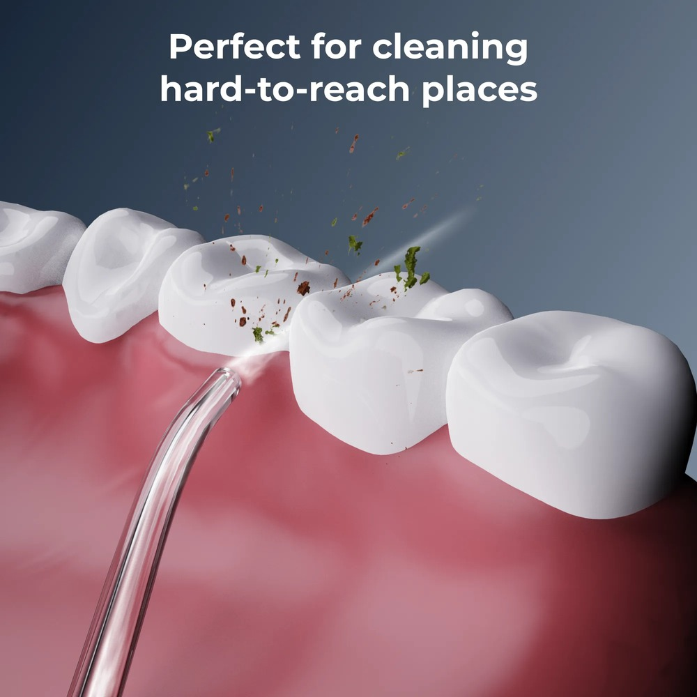 Un idropulsore pulisce i denti bianchi rimuovendo detriti e residui.