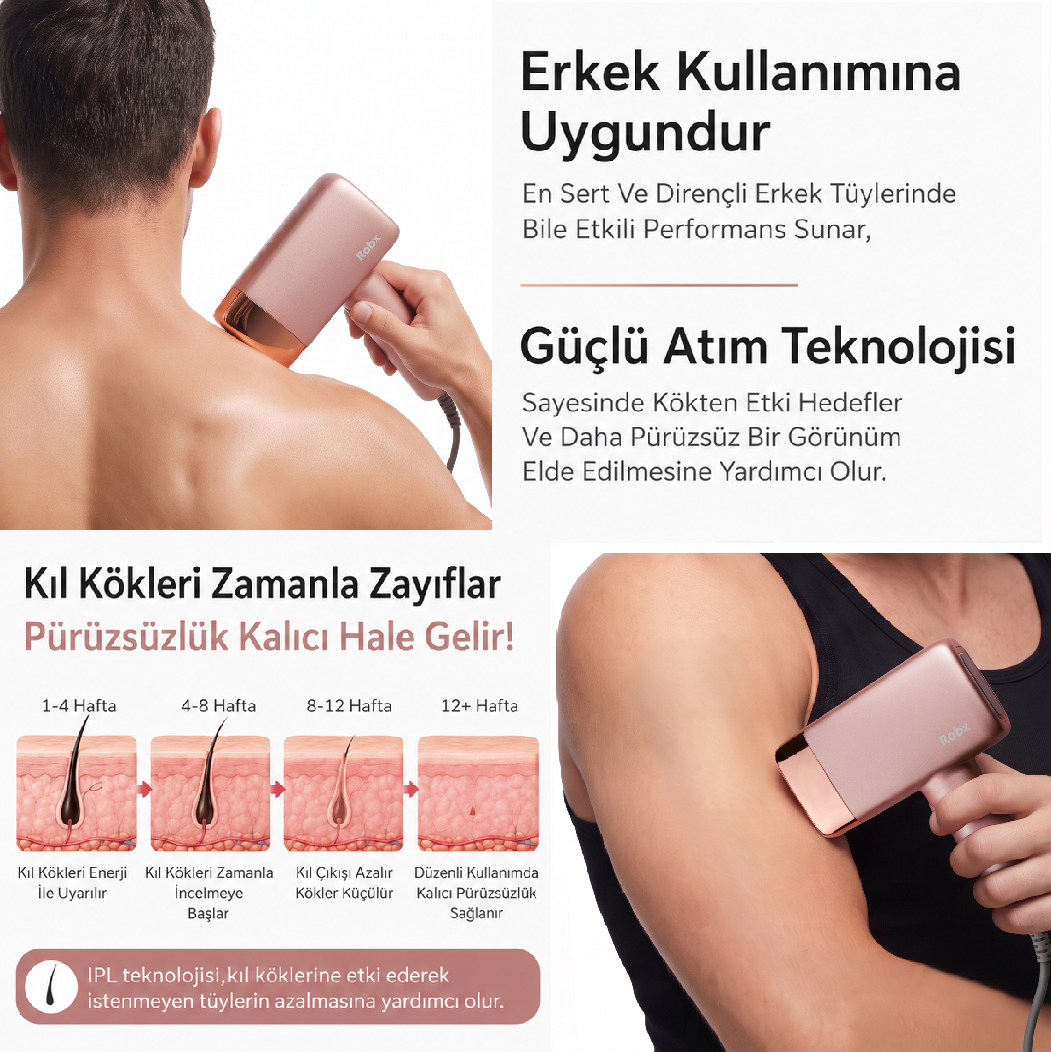 Bir erkek, sırtında ve kolunda pembe altın renkli IPL epilasyon cihazı kullanıyor, Türkçe metin ve grafiklerle.