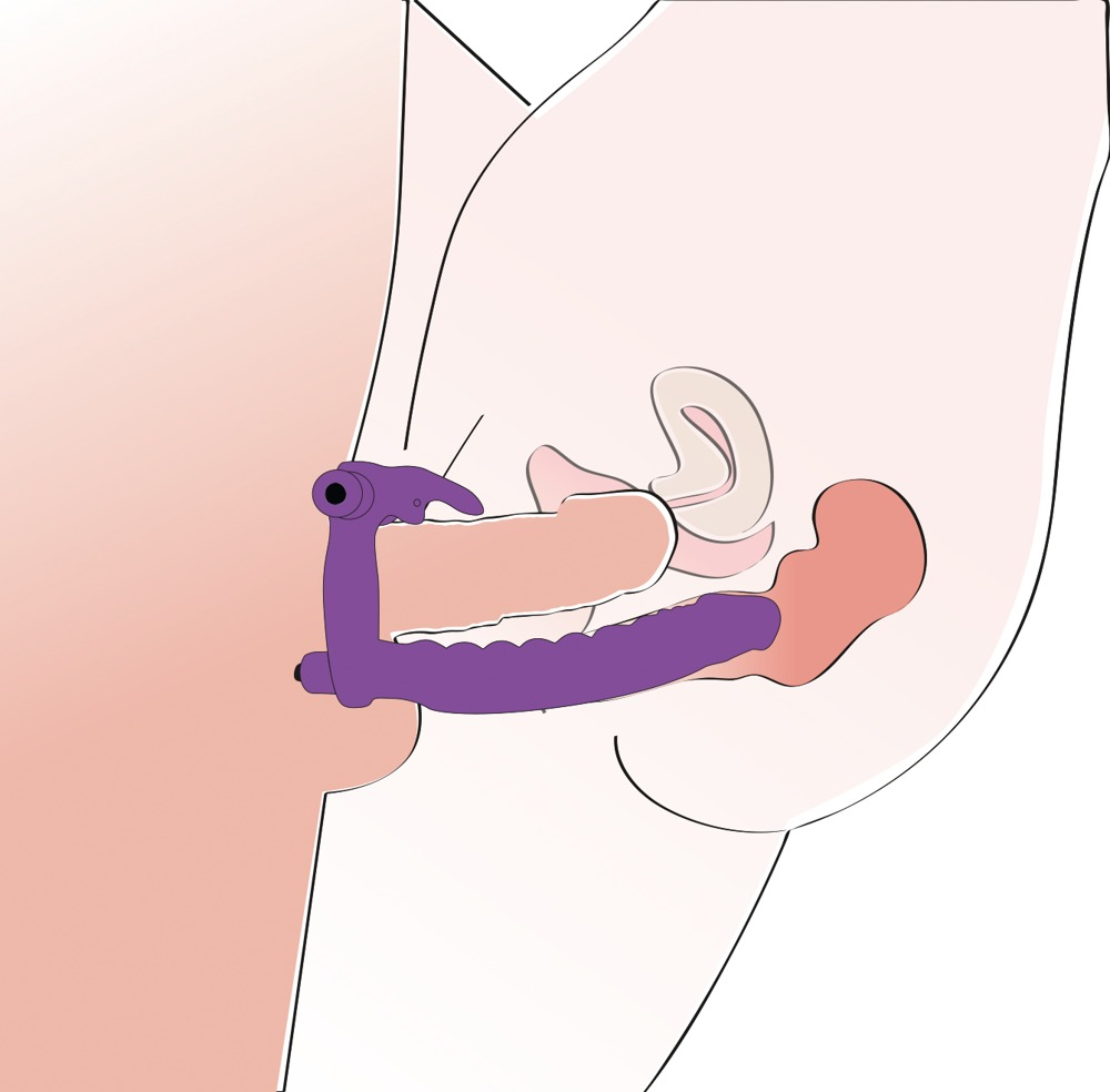 Anatomische Illustration eines violetten Sexspielzeugs, das an einem Phallus getragen wird.