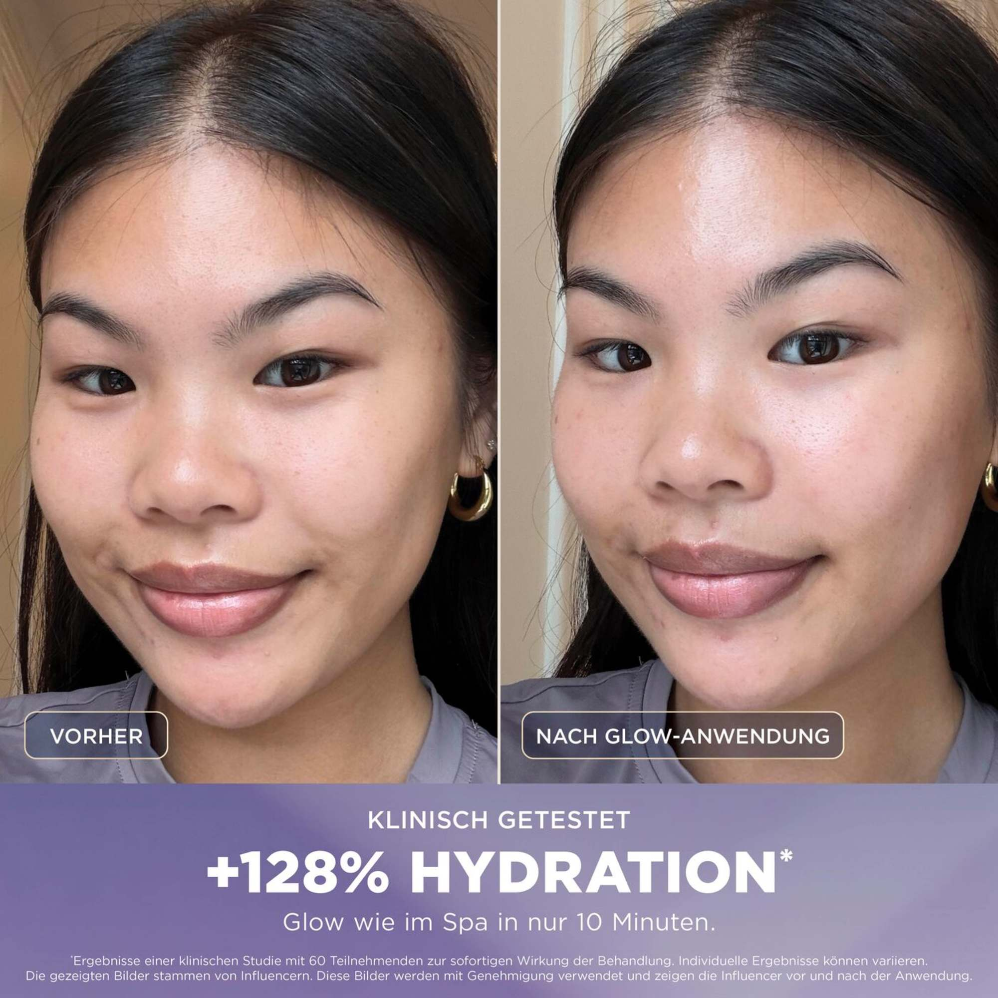 Comparaison avant et après d'une femme montrant une peau lumineuse avec un texte d'hydratation de +128% et test clinique.