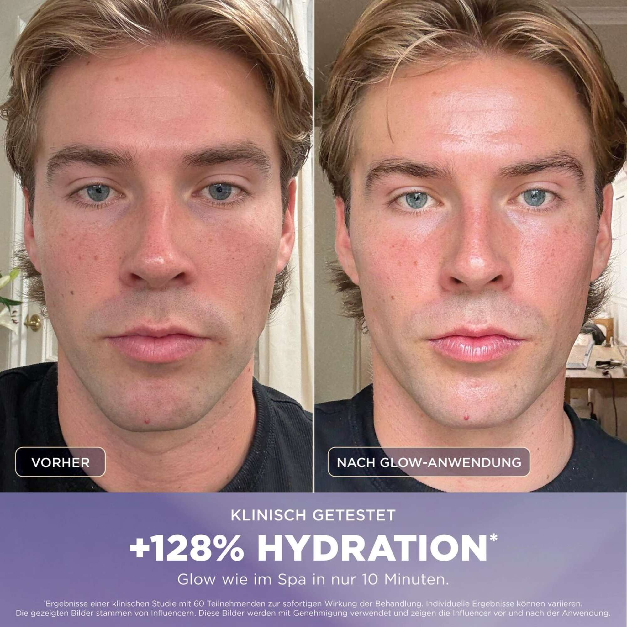 Comparaison avant et après d'un homme avant et après un soin éclat avec hydratation accrue.
