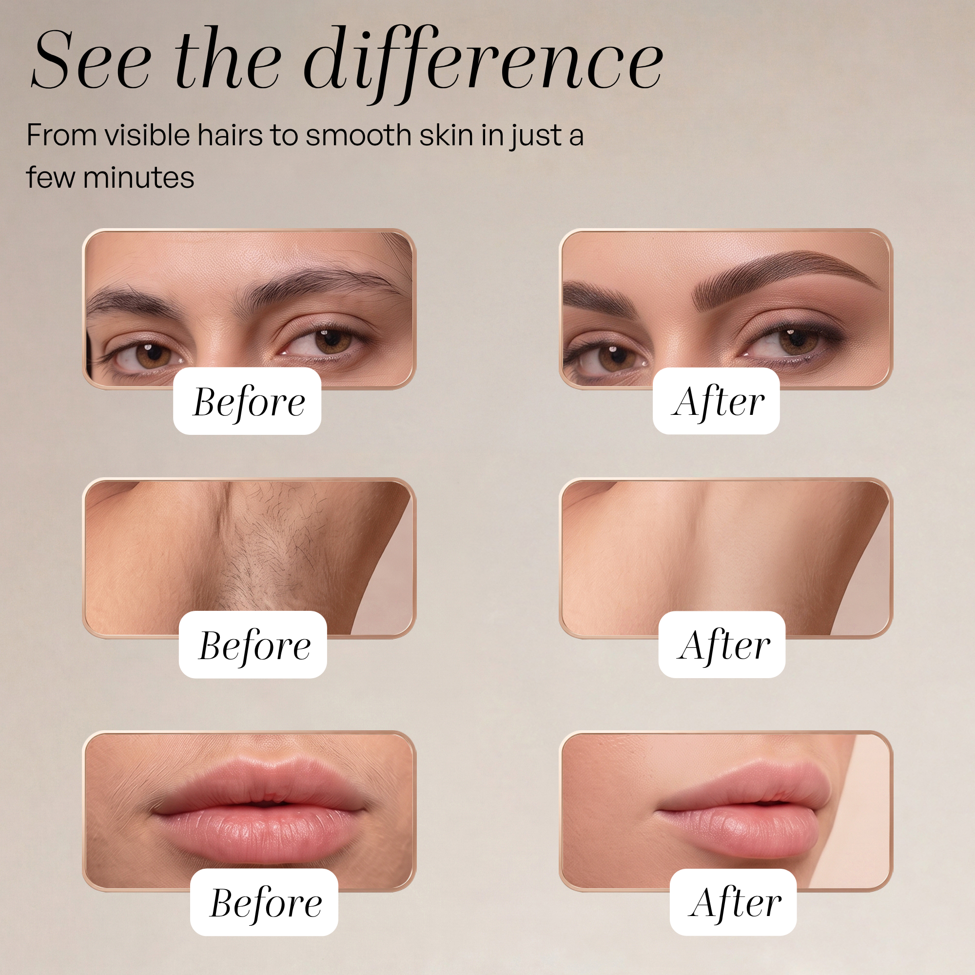 Comparaison avant-après montrant une peau lisse sans poils en quelques minutes.