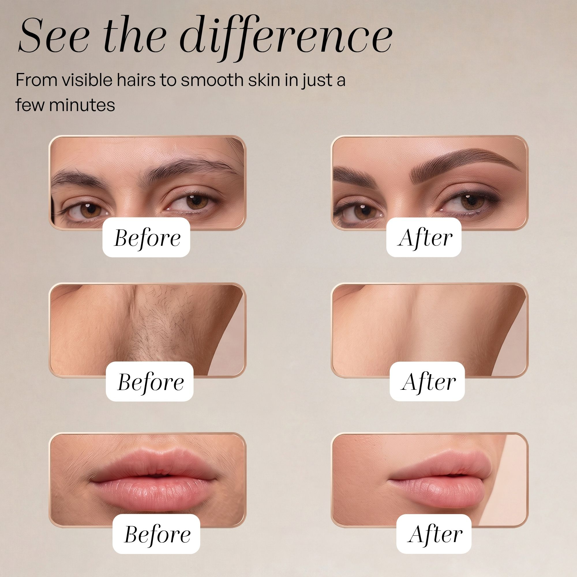 Images avant et après montrant l'épilation des sourcils, du cou et des lèvres.