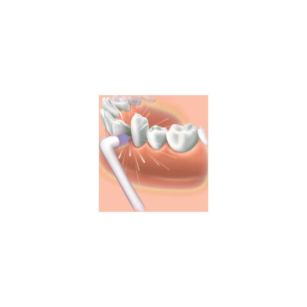 Une illustration montre un hydropulseur pulvérisant de l'eau entre les dents et les gencives.
