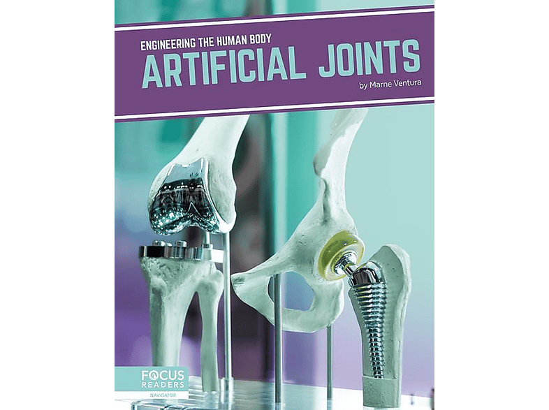 Engineering the Human Body: Artificial Joints | SATURN