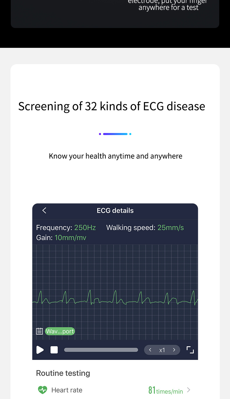 Alkalmazás képernyő EKG adatokkal, percenkénti 81-es pulzusszámmal és 32 EKG betegség szűrésével.
