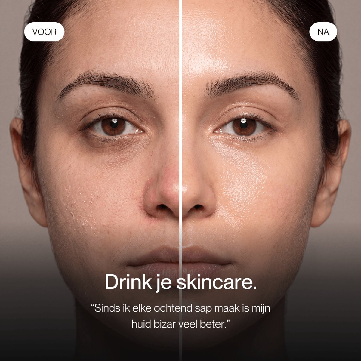 Before and after comparison of a woman's face, showing improved skin texture on the right side.