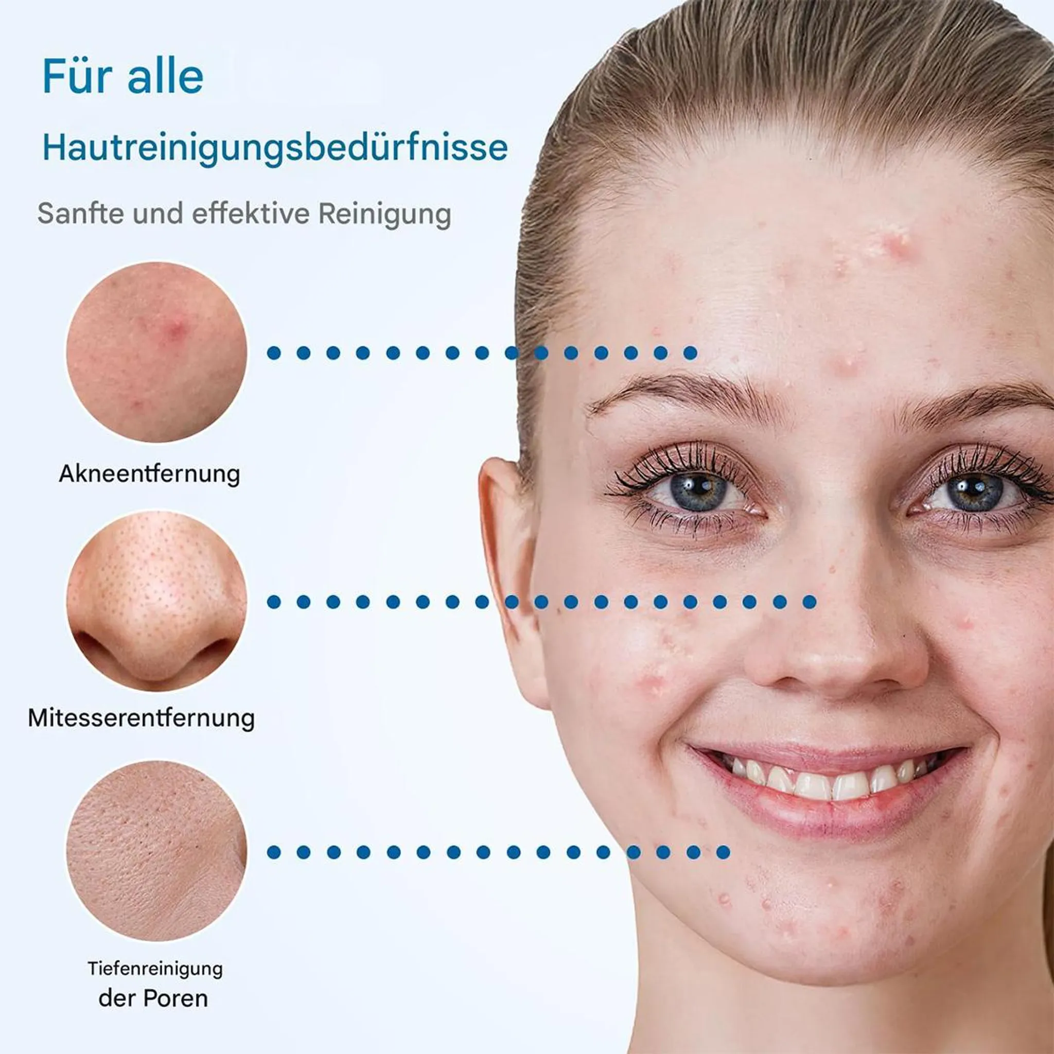 Infografik zeigt eine Frau mit Akne und drei Kreise für Akneentfernung, Mitesserentfernung und Tiefenreinigung der Poren.