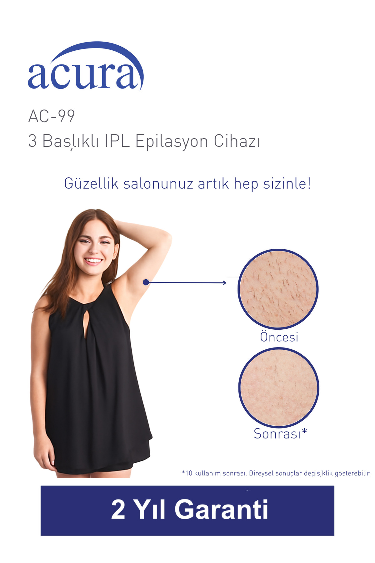 Acura AC-99 IPL epilasyon cihazı reklamı, öncesi ve sonrası cilt sonuçlarıyla.