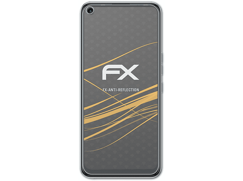 3x FX-Antireflex ATFOLIX Displayschutz(für Camon 17) Tecno