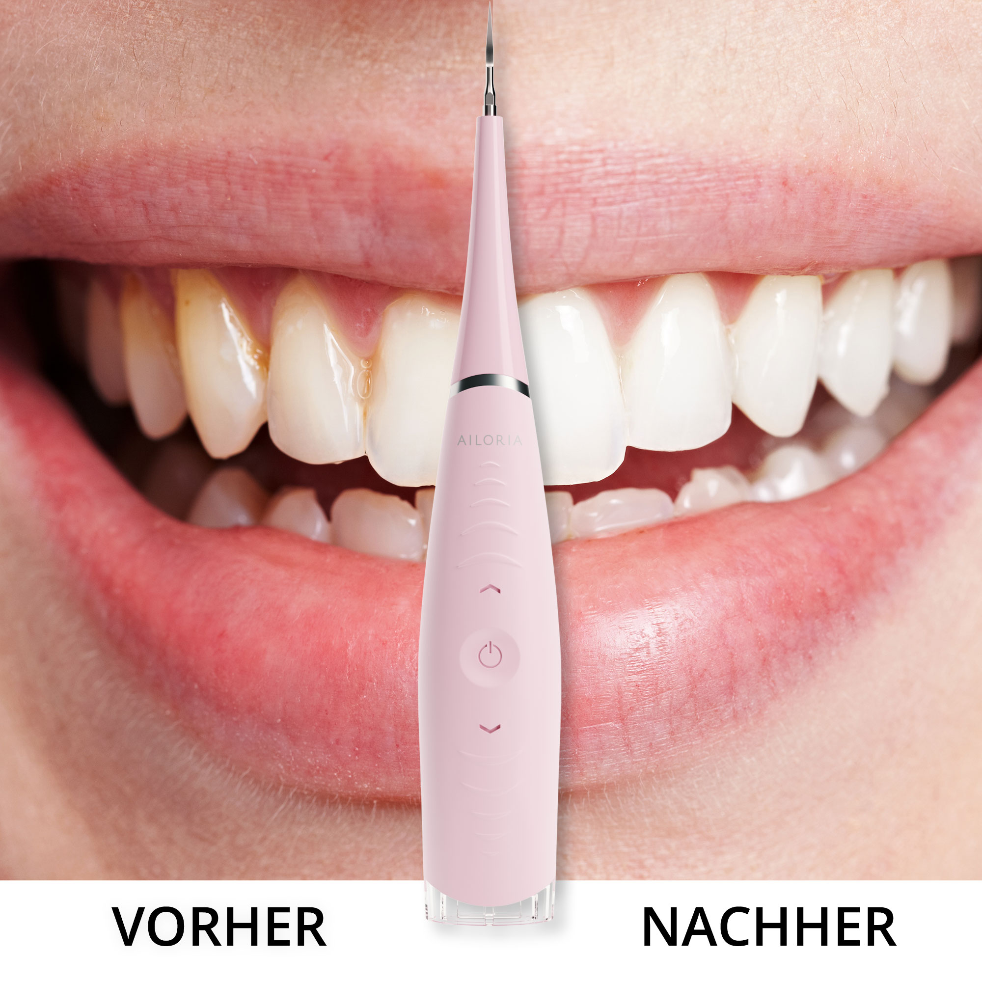 Ein rosa Zahnsteinentferner. Die Zähne werden vor und nach der Reinigung gezeigt. Der Hintergrund ist ein lächelndes Gesicht.