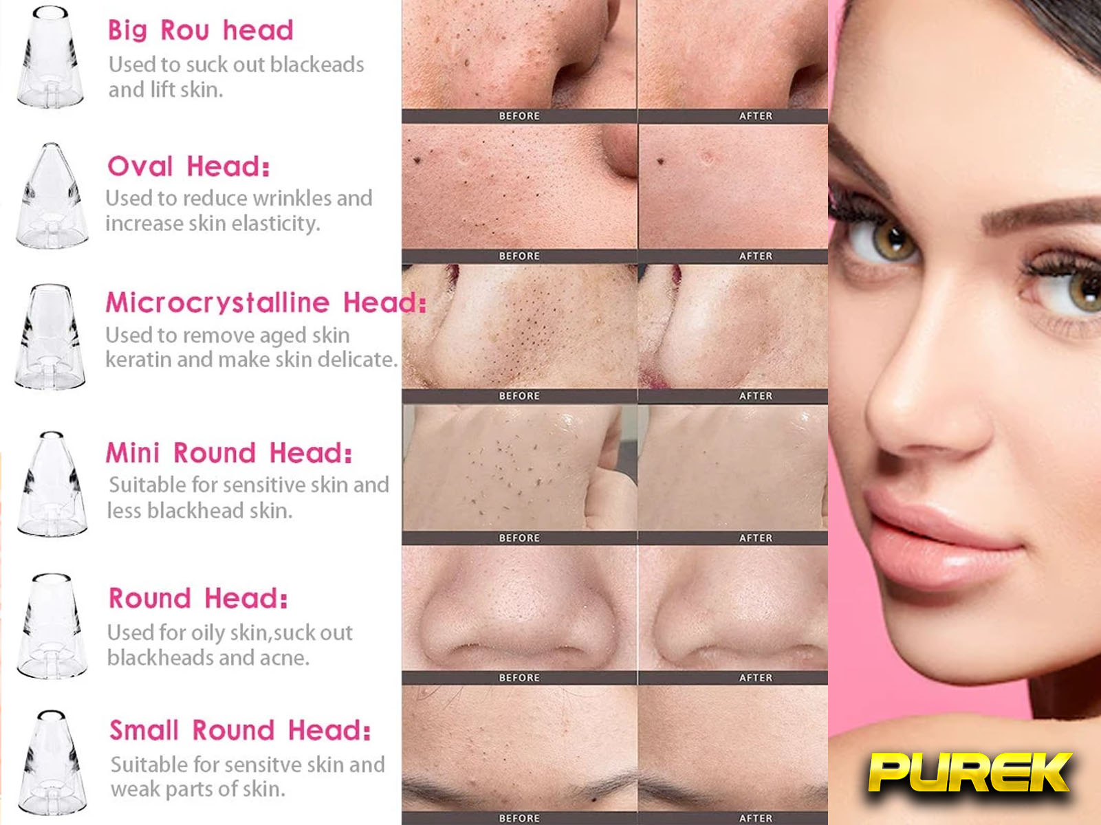 La cara de una mujer junto a diagramas de cabezales de vacío de poros faciales con