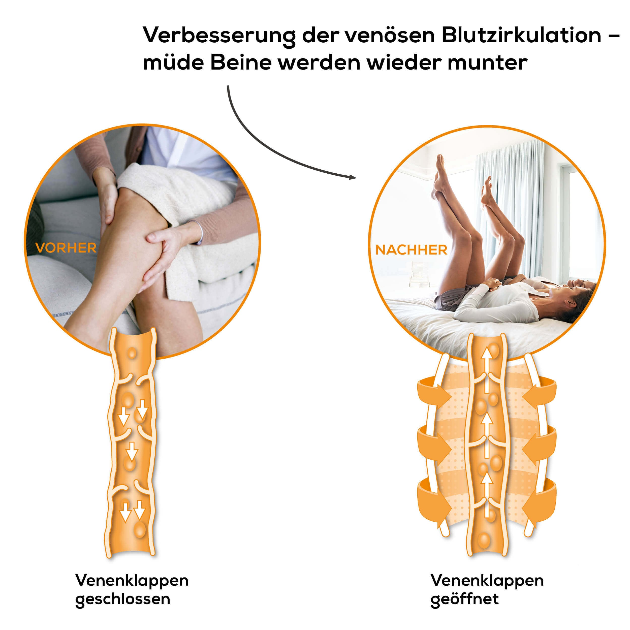 Eine Illustration, die ein Vorher-Nachher der Bein-Zirkulation zeigt, mit Text auf Deutsch.